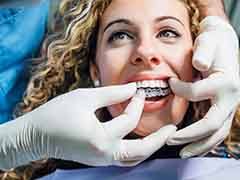 A dentist placing a patient’s new Invisalign trays