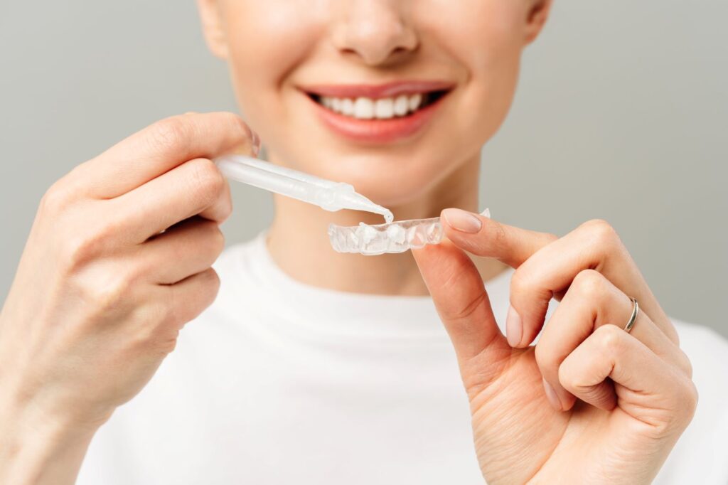 A woman using a professional take-home tooth whitening kit