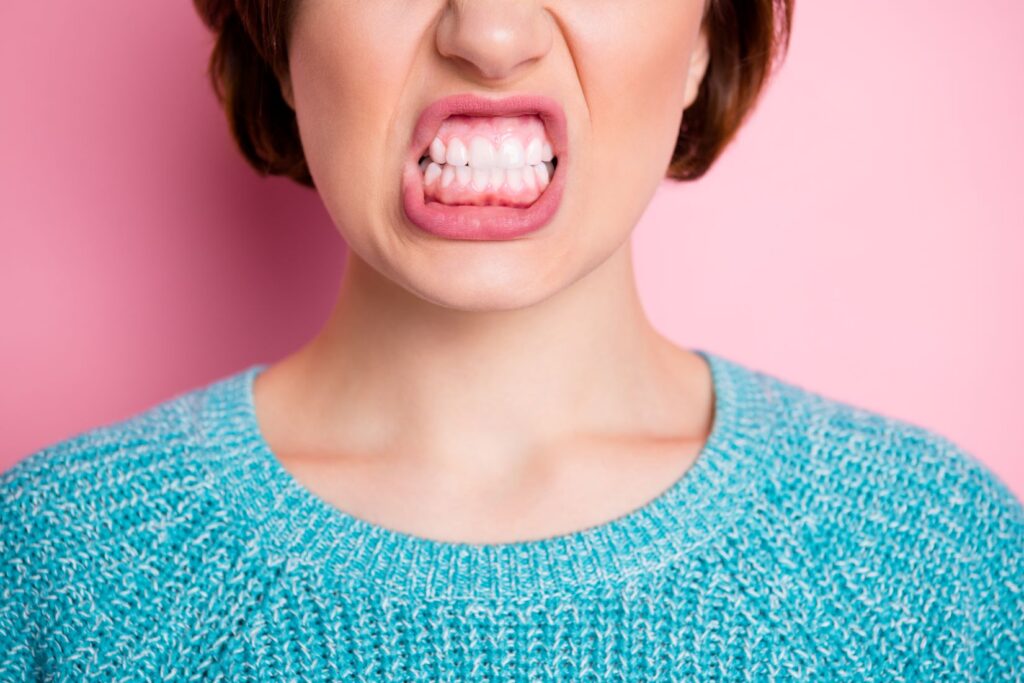 a woman showing her teeth and gums